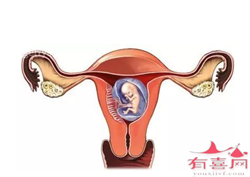 广州助孕试管是什么原因