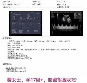 广州双胞胎代孕，广州双子座第三代试管：O型血的人更难怀孕？
