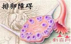 广州代孕可供精卵，广州如何治疗不孕症