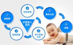 广州代孕包男女，广州促排卵检查